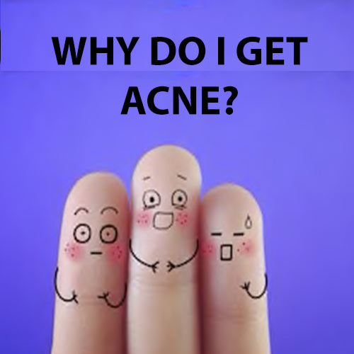 Why Do I Get Acne?
