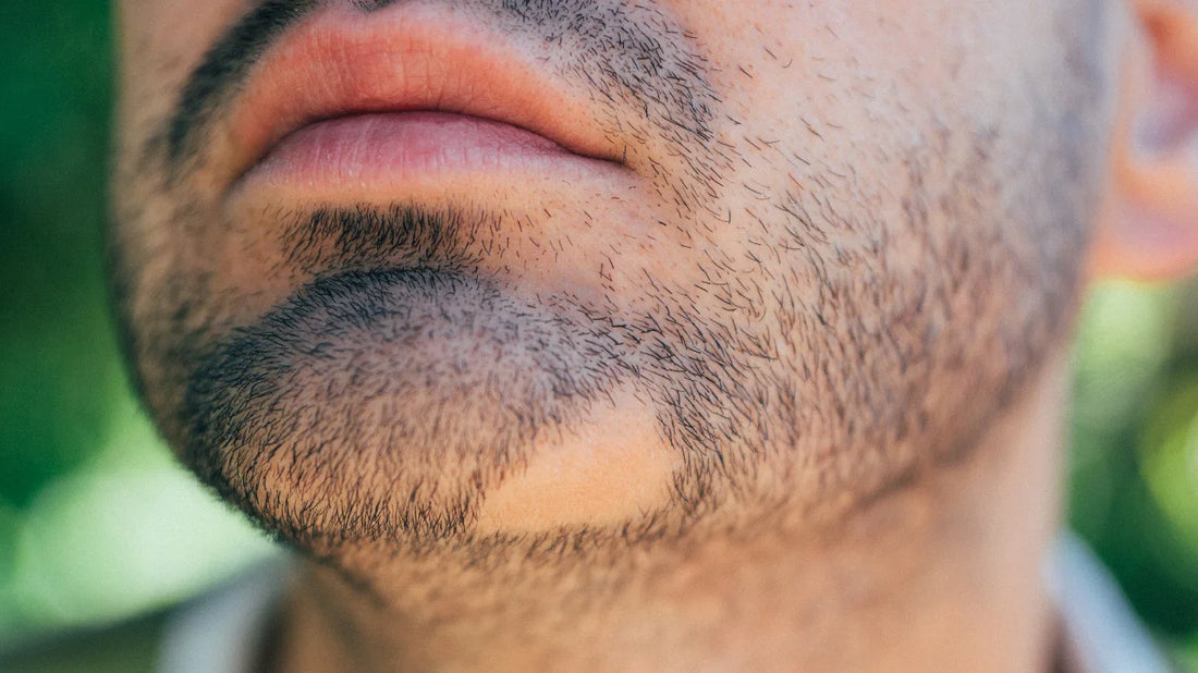 Procapil for Alopecia Areata: Effectiveness, Benefits, and Usage Guide