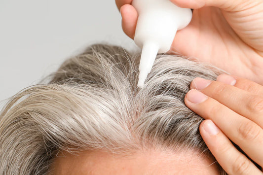 Discover the Effectiveness of Minoxidil with DNA Analysis - Fagron Exclusive Tool