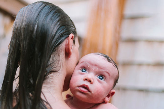 Postpartum Hair Loss: What It Is and Why It Happens