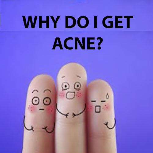 Why Do I Get Acne? 