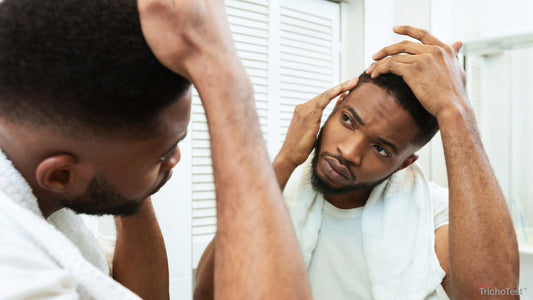 Male Pattern Baldness: Understanding the Most Common Form of Hair Loss
