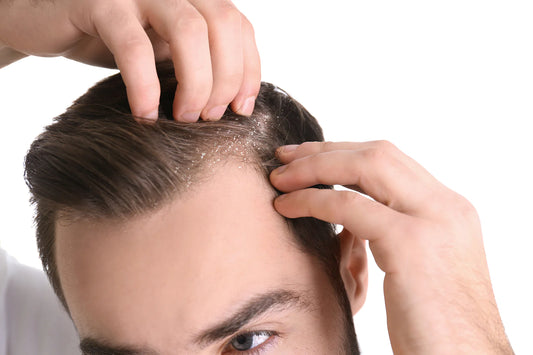A Comparative Analysis of Procapil and Minoxidil: Which is More Effective for Hair Growth?