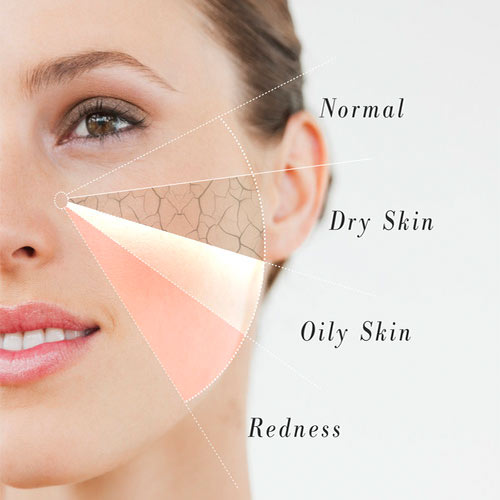 Here is a quick recap of the 5 basic skin types